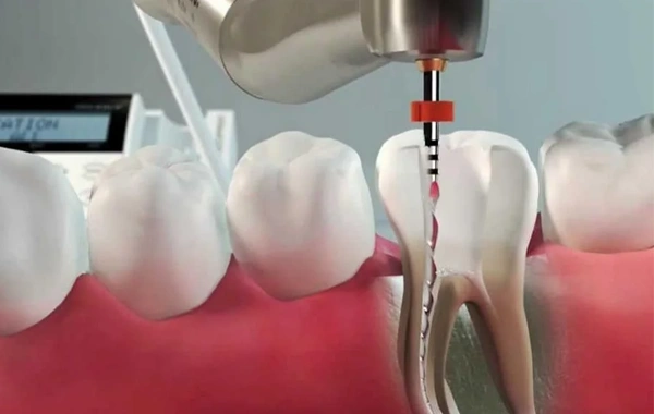 Tratamento de Canal em São Paulo